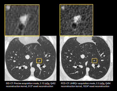 Radiomic Assessment Image