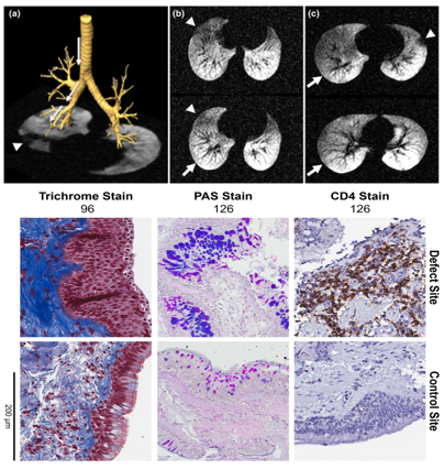 regional mri article