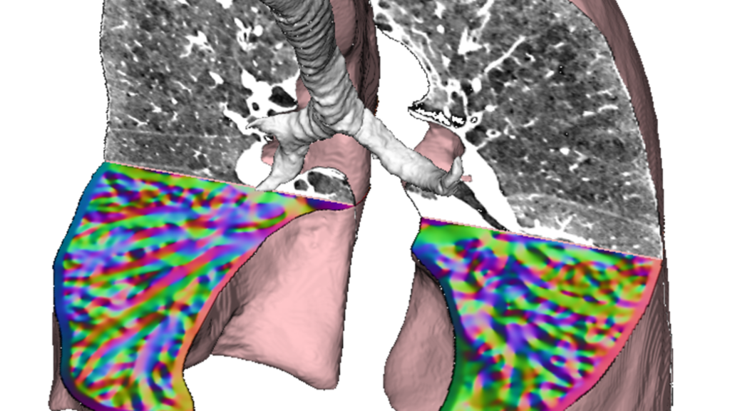 title picture for the PICV Lab