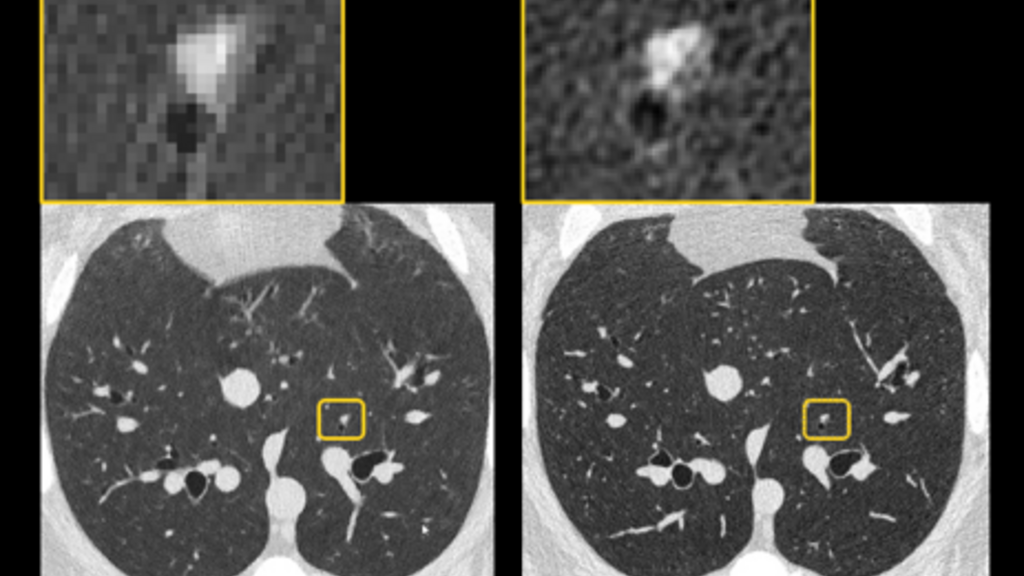 Radiomic Assessment Image